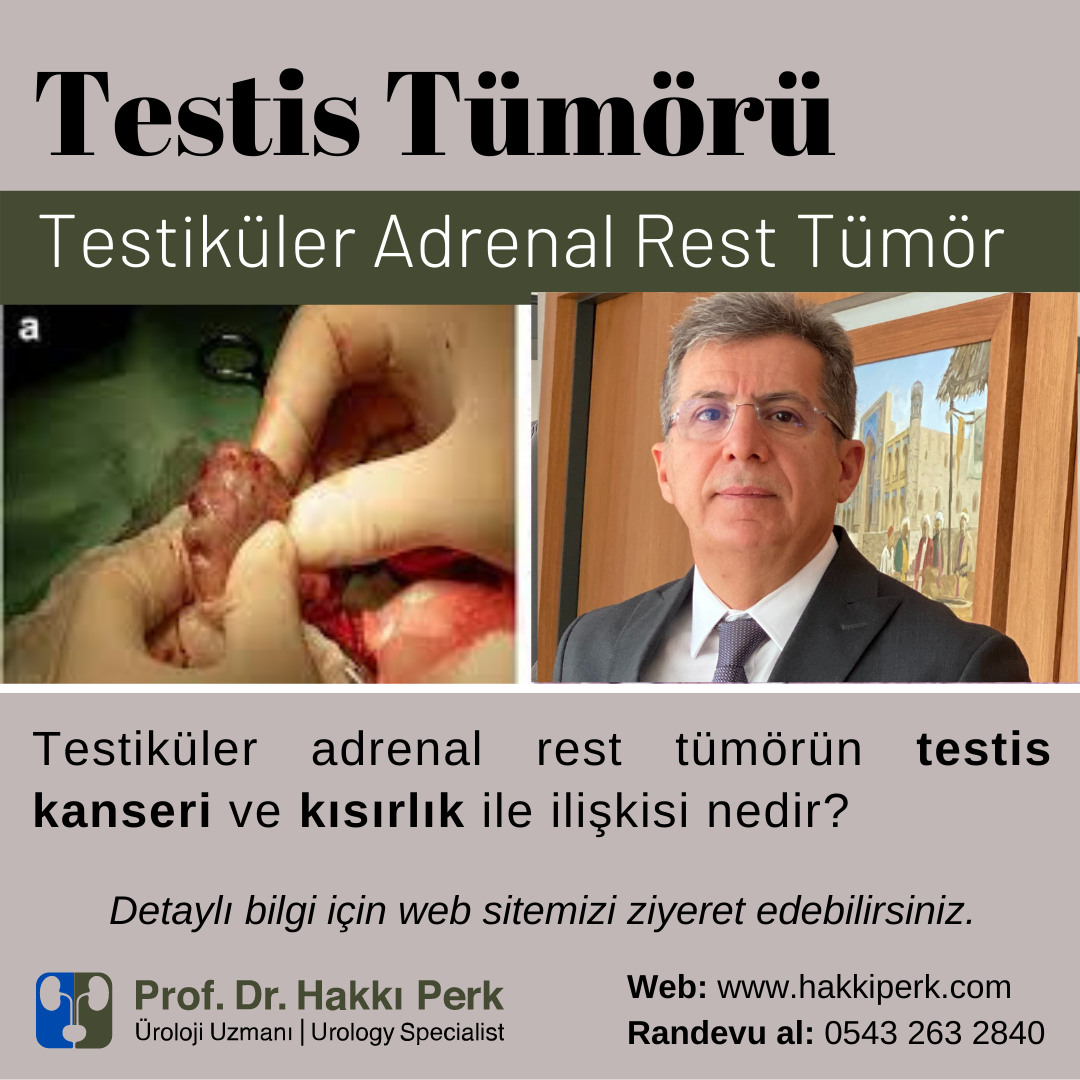Testiküler Adrenal Rest Tümör, Testis Adrenal Artık Tümör-TART
