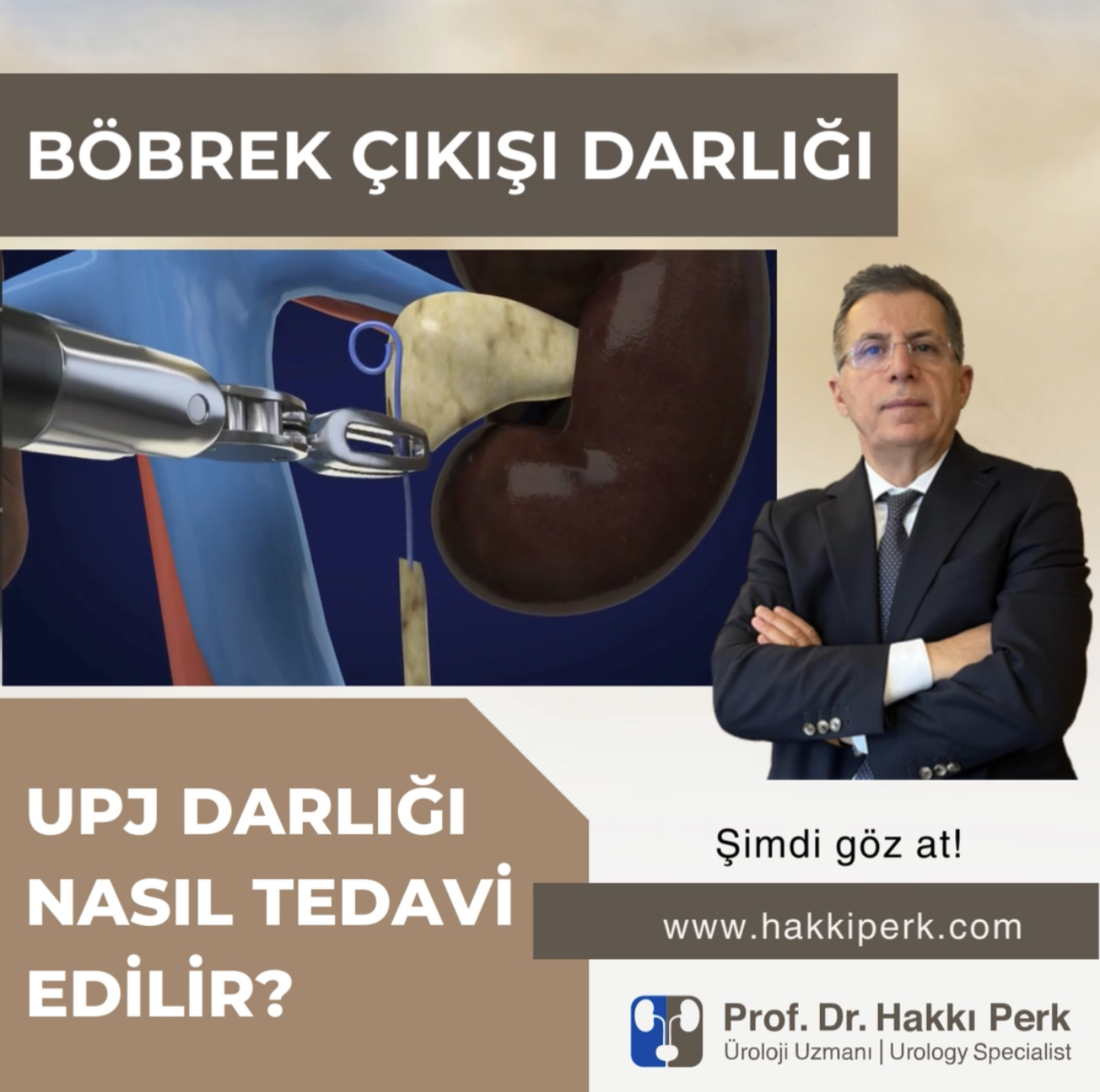 Üreteropelvik Bileşke Darlığı, Üreteropelvik darlık, UPJ  Darlığı