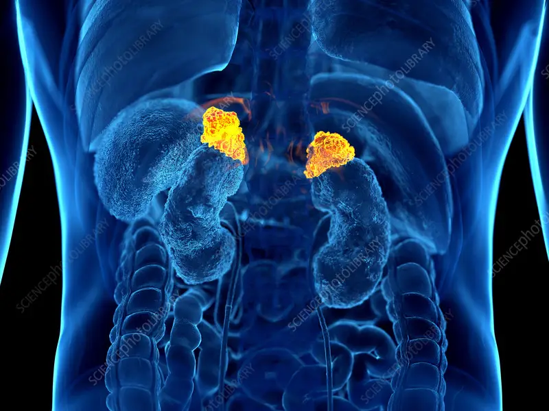 Adrenal Tümörler