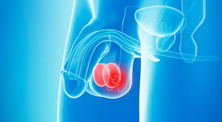 Testis Kanseri