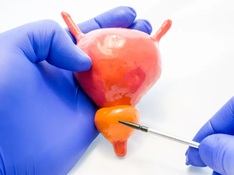 TUIP